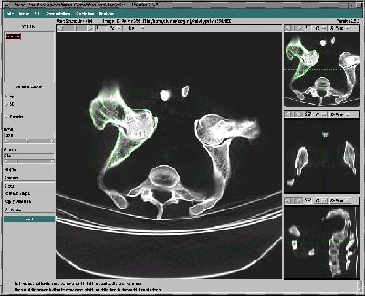 TOSCA Software being used